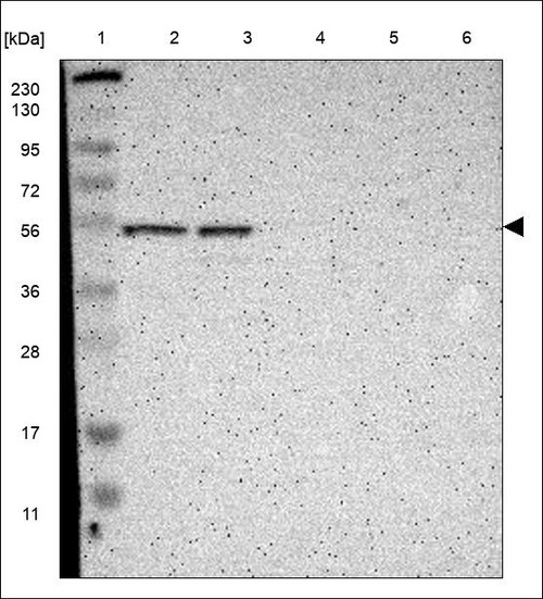 Lane 1: Marker [kDa] 230,130,95,72,56,36,28,17,11 Lane 2: RT4 Lane 3: U-251 MG Lane 4: Human Plasma Lane 5: Liver Lane 6: Tonsil
