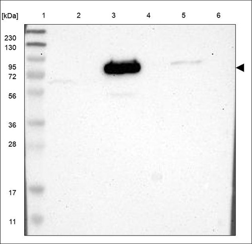 Lane 1: Marker [kDa] 230,130,95,72,56,36,28,17,11 Lane 2: RT4 Lane 3: U-251 MG Lane 4: Human Plasma Lane 5: Liver Lane 6: Tonsil