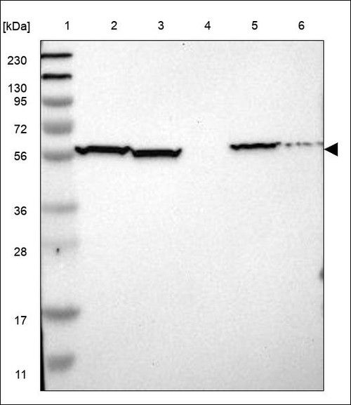 Lane 1: Marker [kDa] 230,130,95,72,56,36,28,17,11 Lane 2: RT4 Lane 3: U-251 MG Lane 4: Human Plasma Lane 5: Liver Lane 6: Tonsil