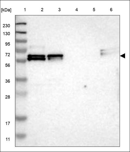 Lane 1: Marker [kDa] 230,130,95,72,56,36,28,17,11 Lane 2: RT4 Lane 3: U-251 MG Lane 4: Human Plasma Lane 5: Liver Lane 6: Tonsil