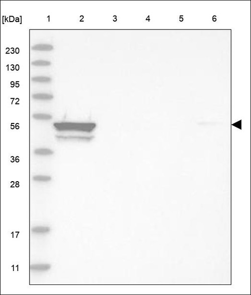 Lane 1: Marker [kDa] 230,130,95,72,56,36,28,17,11 Lane 2: RT4 Lane 3: U-251 MG Lane 4: Human Plasma Lane 5: Liver Lane 6: Tonsil
