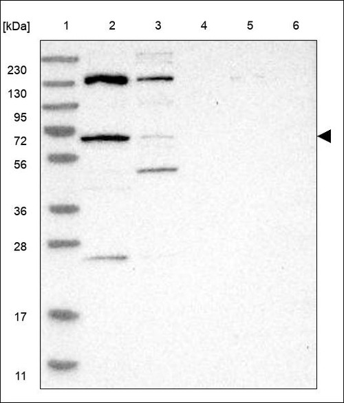 Lane 1: Marker [kDa] 230,130,95,72,56,36,28,17,11 Lane 2: RT4 Lane 3: U-251 MG Lane 4: Human Plasma Lane 5: Liver Lane 6: Tonsil