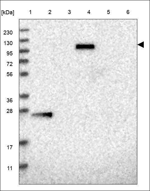 Lane 1: Marker [kDa] 230,130,95,72,56,36,28,17,11 Lane 2: RT4 Lane 3: U-251 MG Lane 4: Human Plasma Lane 5: Liver Lane 6: Tonsil