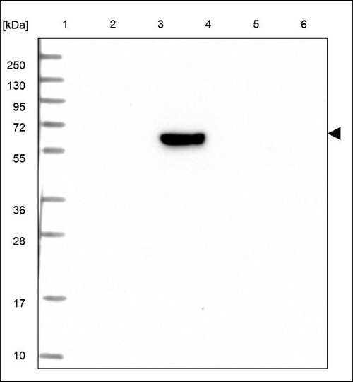Lane 1: Marker [kDa] 250,130,95,72,55,36,28,17,10 Lane 2: RT4 Lane 3: U-251 MG Lane 4: Human Plasma Lane 5: Liver Lane 6: Tonsil