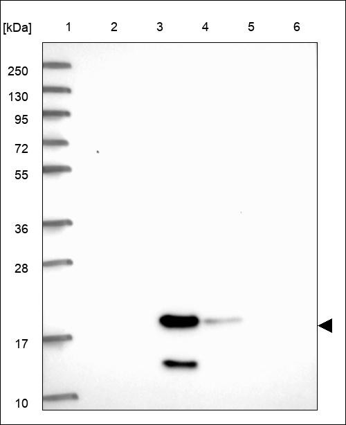 Lane 1: Marker [kDa] 250,130,95,72,55,36,28,17,10 Lane 2: RT4 Lane 3: U-251 MG Lane 4: Human Plasma Lane 5: Liver Lane 6: Tonsil