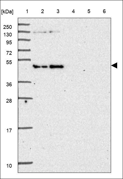 Lane 1: Marker [kDa] 250,130,95,72,55,36,28,17,10 Lane 2: RT4 Lane 3: U-251 MG Lane 4: Human Plasma Lane 5: Liver Lane 6: Tonsil