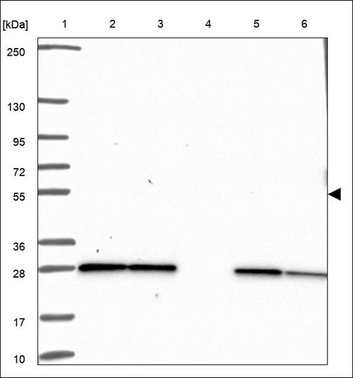 Lane 1: Marker [kDa] 250,130,95,72,55,36,28,17,10 Lane 2: RT4 Lane 3: U-251 MG Lane 4: Human Plasma Lane 5: Liver Lane 6: Tonsil