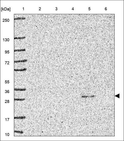 Lane 1: Marker [kDa] 250,130,95,72,55,36,28,17,10 Lane 2: RT4 Lane 3: U-251 MG Lane 4: Human Plasma Lane 5: Liver Lane 6: Tonsil