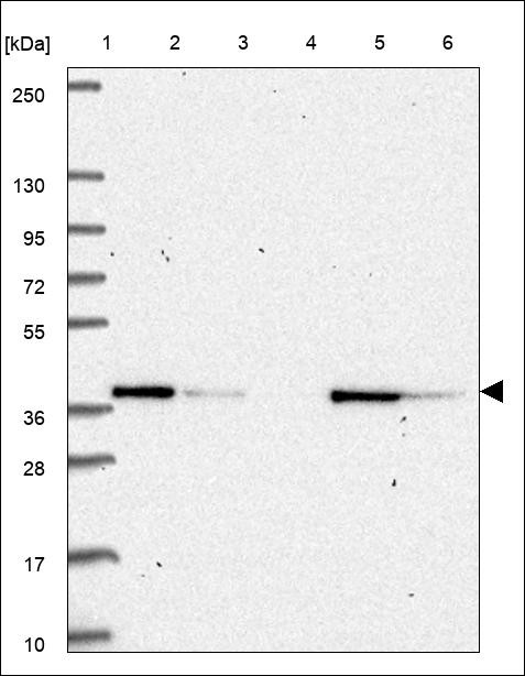Lane 1: Marker [kDa] 250,130,95,72,55,36,28,17,10 Lane 2: RT4 Lane 3: U-251 MG Lane 4: Human Plasma Lane 5: Liver Lane 6: Tonsil