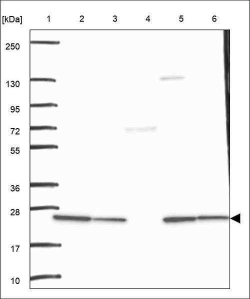 Lane 1: Marker [kDa] 250,130,95,72,55,36,28,17,10 Lane 2: RT4 Lane 3: U-251 MG Lane 4: Human Plasma Lane 5: Liver Lane 6: Tonsil