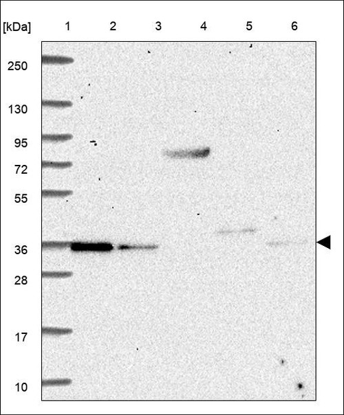 Lane 1: Marker [kDa] 250,130,95,72,55,36,28,17,10 Lane 2: RT4 Lane 3: U-251 MG Lane 4: Human Plasma Lane 5: Liver Lane 6: Tonsil