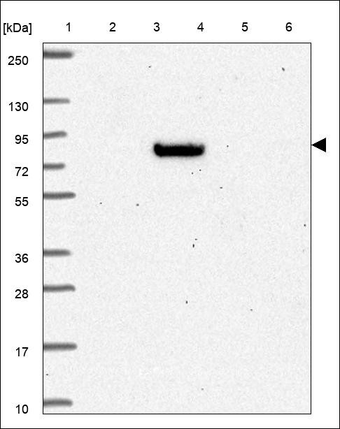 Lane 1: Marker [kDa] 250,130,95,72,55,36,28,17,10 Lane 2: RT4 Lane 3: U-251 MG Lane 4: Human Plasma Lane 5: Liver Lane 6: Tonsil