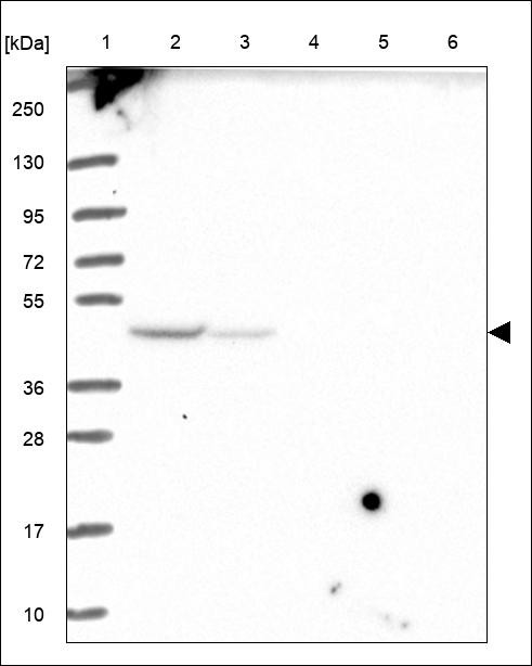 Lane 1: Marker [kDa] 250,130,95,72,55,36,28,17,10 Lane 2: RT4 Lane 3: U-251 MG Lane 4: Human Plasma Lane 5: Liver Lane 6: Tonsil