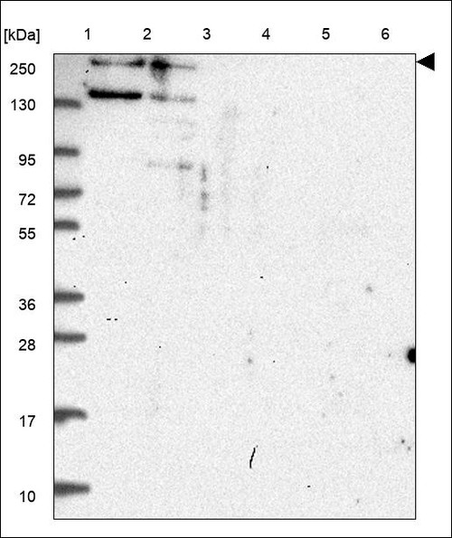 Lane 1: Marker [kDa] 250,130,95,72,55,36,28,17,10 Lane 2: RT4 Lane 3: U-251 MG Lane 4: Human Plasma Lane 5: Liver Lane 6: Tonsil