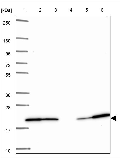 Lane 1: Marker [kDa] 250,130,95,72,55,36,28,17,10 Lane 2: RT4 Lane 3: U-251 MG Lane 4: Human Plasma Lane 5: Liver Lane 6: Tonsil