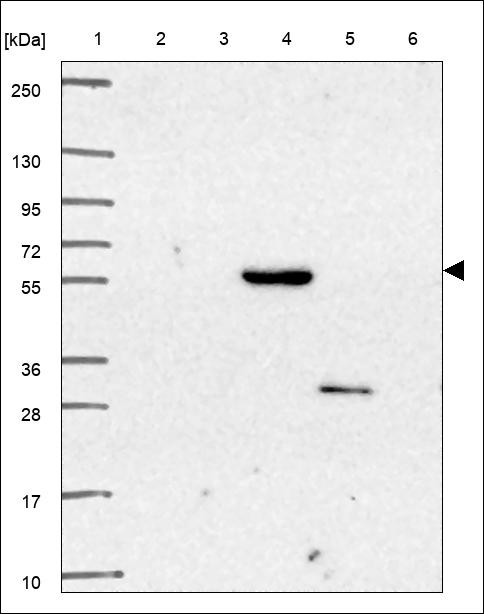 Lane 1: Marker [kDa] 250,130,95,72,55,36,28,17,10 Lane 2: RT4 Lane 3: U-251 MG Lane 4: Human Plasma Lane 5: Liver Lane 6: Tonsil