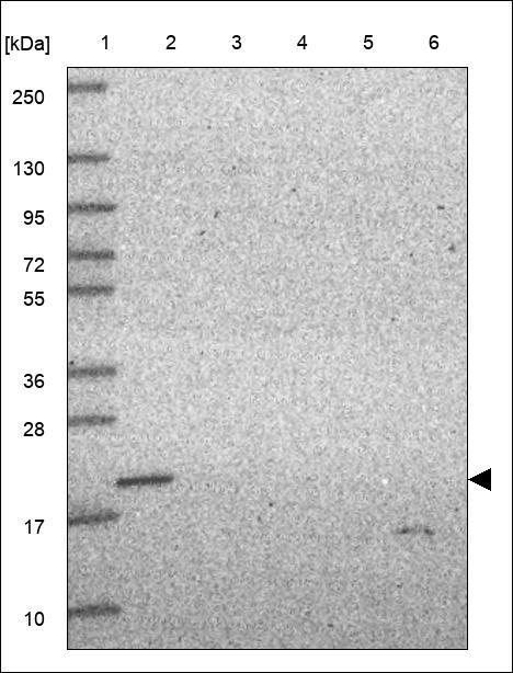Lane 1: Marker [kDa] 250,130,95,72,55,36,28,17,10 Lane 2: RT4 Lane 3: U-251 MG Lane 4: Human Plasma Lane 5: Liver Lane 6: Tonsil