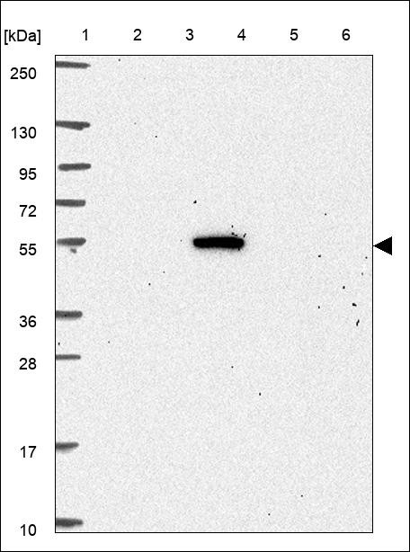 Lane 1: Marker [kDa] 250,130,95,72,55,36,28,17,10 Lane 2: RT4 Lane 3: U-251 MG Lane 4: Human Plasma Lane 5: Liver Lane 6: Tonsil