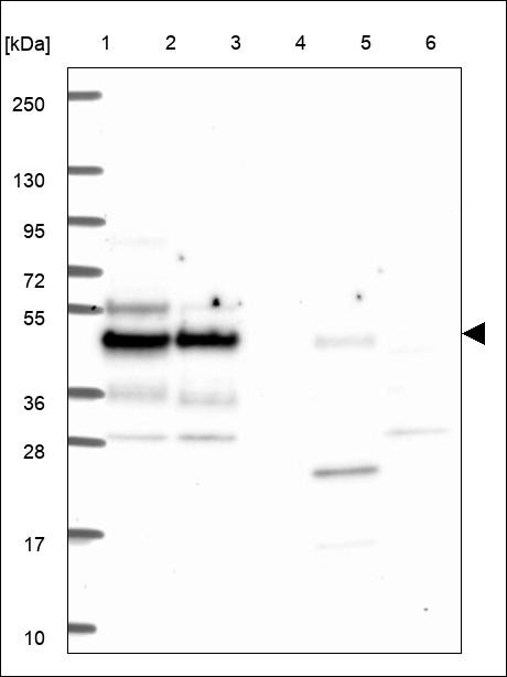 Lane 1: Marker [kDa] 250,130,95,72,55,36,28,17,10 Lane 2: RT4 Lane 3: U-251 MG Lane 4: Human Plasma Lane 5: Liver Lane 6: Tonsil