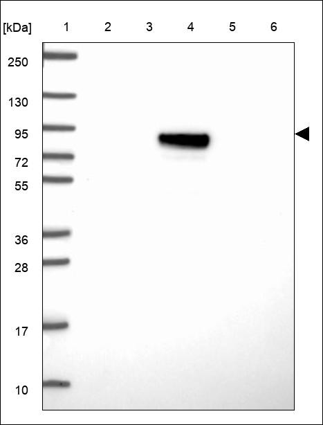 Lane 1: Marker [kDa] 250,130,95,72,55,36,28,17,10 Lane 2: RT4 Lane 3: U-251 MG Lane 4: Human Plasma Lane 5: Liver Lane 6: Tonsil