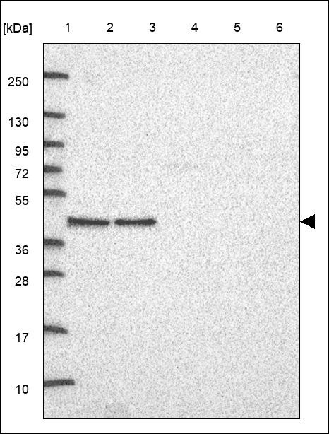 Lane 1: Marker [kDa] 250,130,95,72,55,36,28,17,10 Lane 2: RT4 Lane 3: U-251 MG Lane 4: Human Plasma Lane 5: Liver Lane 6: Tonsil