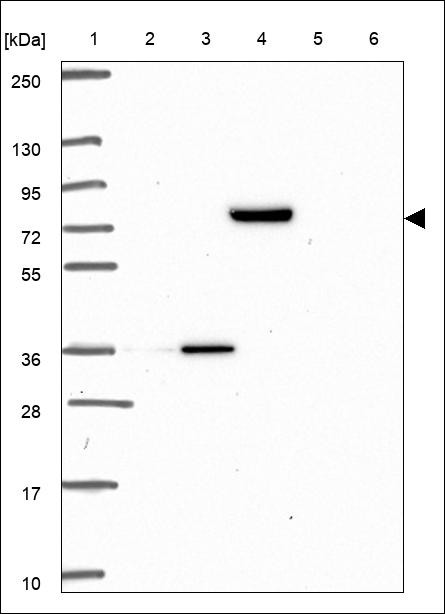 Lane 1: Marker [kDa] 250,130,95,72,55,36,28,17,10 Lane 2: RT4 Lane 3: U-251 MG Lane 4: Human Plasma Lane 5: Liver Lane 6: Tonsil