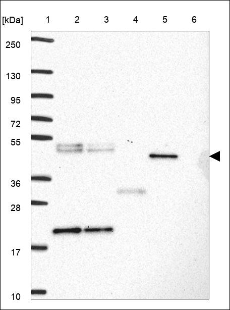 Lane 1: Marker [kDa] 250,130,95,72,55,36,28,17,10 Lane 2: RT4 Lane 3: U-251 MG Lane 4: Human Plasma Lane 5: Liver Lane 6: Tonsil