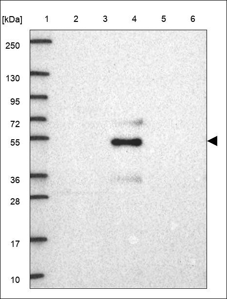 Lane 1: Marker [kDa] 250,130,95,72,55,36,28,17,10 Lane 2: RT4 Lane 3: U-251 MG Lane 4: Human Plasma Lane 5: Liver Lane 6: Tonsil