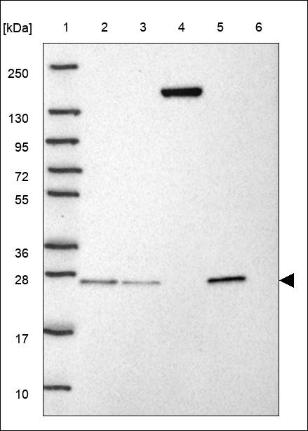 Lane 1: Marker [kDa] 250,130,95,72,55,36,28,17,10 Lane 2: RT4 Lane 3: U-251 MG Lane 4: Human Plasma Lane 5: Liver Lane 6: Tonsil