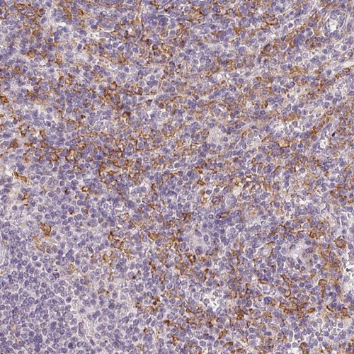 Immunohistochemical staining of human spleen shows strong membranous positivity in cells in red pulp.
