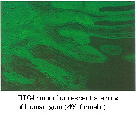 Anti Type I Collagen (raised against human) pAb (Rabbit, Antiserum)