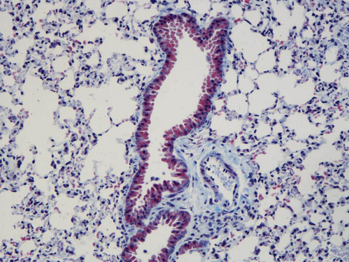 Gomori Trichrome Stain Kit