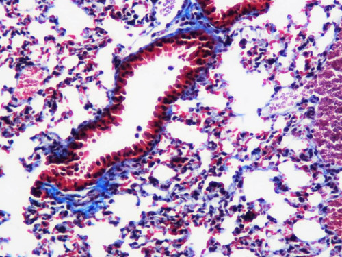 Masson's Trichrome Stain Kit