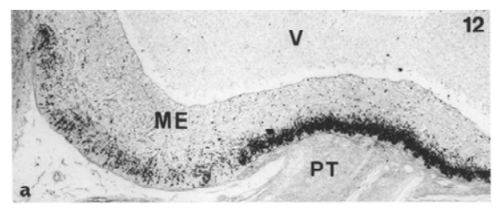 Anti Avian Gonadotropin-Releasing Hormone I (GnRH-I/LH-RH I) pAb (Rabbit, Antiserum)