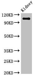 Western BlotPositive WB detected in: Mouse kidney tissueAll lanes: ANPEP antibody at 3.4µg/mlSecondaryGoat polyclonal to rabbit IgG at 1/50000 dilutionPredicted band size: 110 kDaObserved band size: 110 kDa 