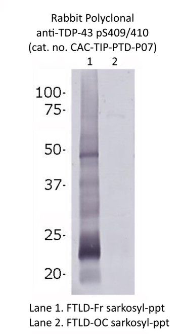 Immunoblot analyses with pAb pS409/410: Sarkosyl-insoluble fractions prepared from frontal lobe (Lane 1) and occipital lobe of a FTLD case (type C) were immunoblotted with this antibody (1/1000 dilution). Phosphorylated full-length TDP-43 at 45 kDa, 18~25 kDa C-terminal fragments were detected in the sample prepared from frontal lobe.