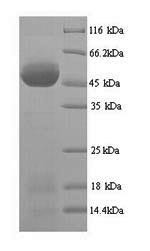(Tris-Glycine gel) Discontinuous SDS-PAGE (reduced) with 5% enrichment gel and 15% separation gel.