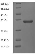 (Tris-Glycine gel) Discontinuous SDS-PAGE (reduced) with 5% enrichment gel and 15% separation gel.