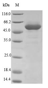 (Tris-Glycine gel) Discontinuous SDS-PAGE (reduced) with 5% enrichment gel and 15% separation gel.
