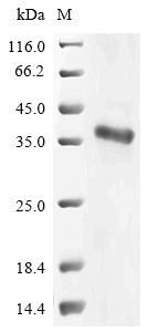 (Tris-Glycine gel) Discontinuous SDS-PAGE (reduced) with 5% enrichment gel and 15% separation gel.