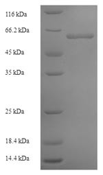 (Tris-Glycine gel) Discontinuous SDS-PAGE (reduced) with 5% enrichment gel and 15% separation gel.