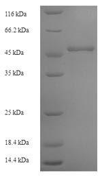 (Tris-Glycine gel) Discontinuous SDS-PAGE (reduced) with 5% enrichment gel and 15% separation gel.