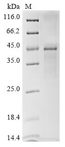 (Tris-Glycine gel) Discontinuous SDS-PAGE (reduced) with 5% enrichment gel and 15% separation gel.