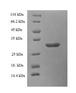 (Tris-Glycine gel) Discontinuous SDS-PAGE (reduced) with 5% enrichment gel and 15% separation gel.