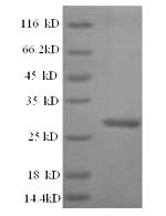 (Tris-Glycine gel) Discontinuous SDS-PAGE (reduced) with 5% enrichment gel and 15% separation gel.