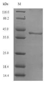 (Tris-Glycine gel) Discontinuous SDS-PAGE (reduced) with 5% enrichment gel and 15% separation gel.
