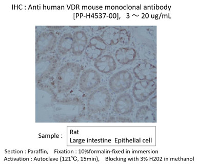 Anti VDR mAb (Clone H4537)