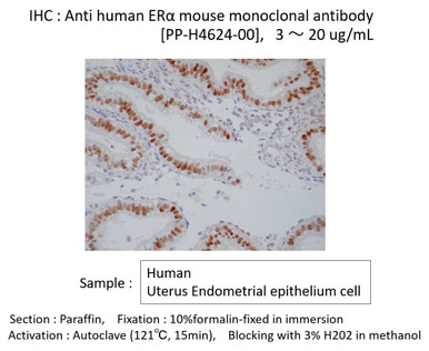 Anti Estrogen Receptor 1 (ESR1/ER-Alpha) mAb (Clone H4624)