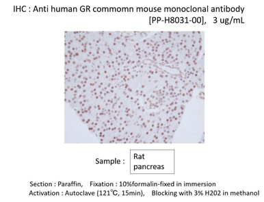 Anti Glucocorticoid Receptor (GR/NR3C1) Alpha and Beta mAb (Clone H8031)
