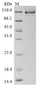 Amyloid Beta A4 Precursor Protein-Binding Family A Member 2 (APBA2) N-terminal 10xHis-tagged and C-terminal Myc-tagged (E. coli-derived, recombinant human)